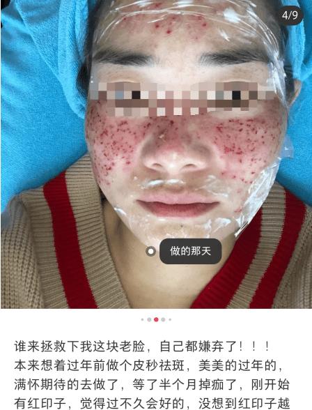 伊屏清斑效果如何？（揭秘伊屏清斑神器效果真假）